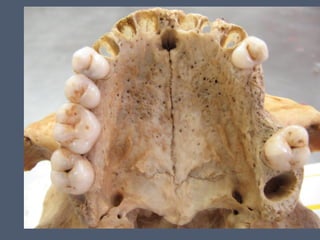 14 cavidad nasal y_senos_perinasales_2_ - 