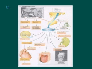 Endocrine Ros Examples 14 disorders of_endocrine_system | PPT