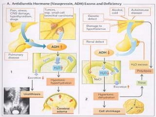 14 Disorders_of_endocrine_system and possible causes.ppt
