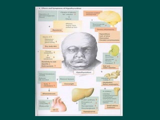 14 Disorders_of_endocrine_system and possible causes.ppt