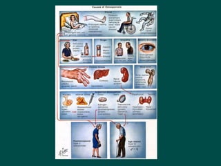 14Disorders_of_endocrine_system signs and symptoms .ppt