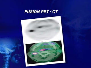 FUSION PET / CT
27
 