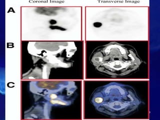 10/21/2016 31 nuclear medicine
 