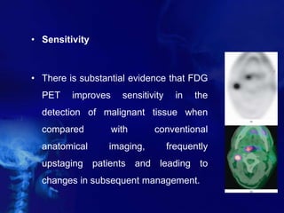 • Sensitivity
• There is substantial evidence that FDG
PET improves sensitivity in the
detection of malignant tissue when
compared with conventional
anatomical imaging, frequently
upstaging patients and leading to
changes in subsequent management.
 