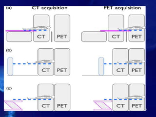 10/21/2016 36 nuclear medicine
 