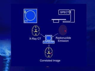 38
Computer
Correlated Image
CT
X-Ray CT Radionuclide
Emission
SPECT
 