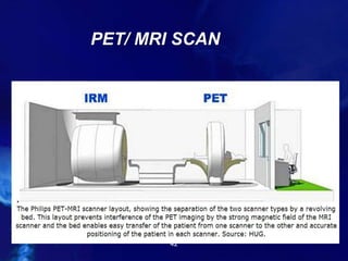 PET/ MRI SCAN
42
 