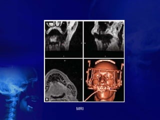 MRI
 