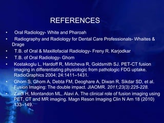 REFERENCES
• Oral Radiology- White and Pharoah
• Radiography and Radiology for Dental Care Professionals- Whaites &
Drage
• T.B. of Oral & Maxillofacial Radiology- Freny R. Karjodkar
• T.B. of Oral Radiology- Ghom
• Kostakoglu L, Hardoff R, Mirtcheva R, Goldsmith SJ. PET-CT fusion
imaging in differentiating physiologic from pathologic FDG uptake.
RadioGraphics 2004; 24:1411–1431.
• Ghom S, Ghom A, Debta FM, Deoghare A, Diwan R, Sikdar SD, et al.
Fusion Imaging: The double impact. JIAOMR. 2011;23(3):225-228.
• Zaidi H, Montandon ML, Alavi A. The clinical role of fusion imaging using
PET, CT and MR imaging. Magn Reson Imaging Clin N Am 18 (2010)
133–149.
 