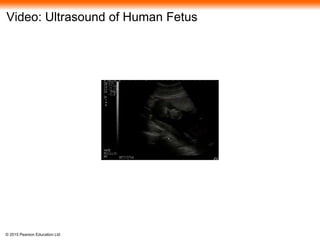 © 2015 Pearson Education Ltd
Video: Ultrasound of Human Fetus
 
