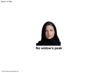 © 2015 Pearson Education Ltd.
Figure 14.15ab
No widow’s peak
 