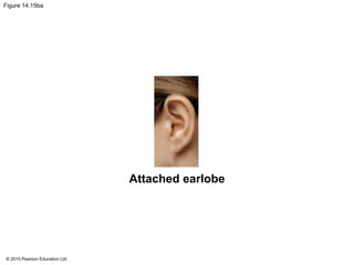 © 2015 Pearson Education Ltd.
Figure 14.15ba
Attached earlobe
 