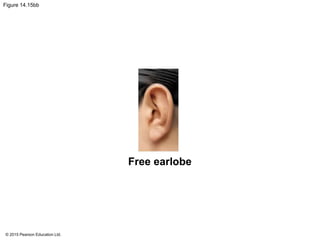 © 2015 Pearson Education Ltd.
Figure 14.15bb
Free earlobe
 