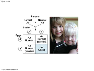 © 2015 Pearson Education Ltd.
Figure 14.16
Eggs
Sperm
Normal Normal
Parents
Normal
Aa Aa
Aa
Aa
aa
AA
A a
a
A
Normal
(carrier)
Normal
(carrier)
Albino
 