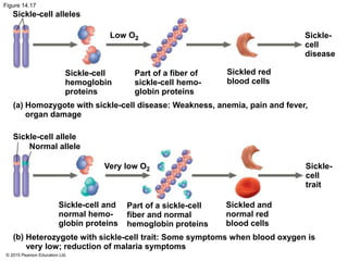 © 2015 Pearson Education Ltd.
Figure 14.17
Sickle-cell alleles
Low O2
Sickle-cell
hemoglobin
proteins
Sickled red
blood cells
Part of a fiber of
sickle-cell hemo-
globin proteins
Sickle-cell allele
Normal allele
Very low O2
Sickle-
cell
disease
Sickle-
cell
trait
Sickled and
normal red
blood cells
Part of a sickle-cell
fiber and normal
hemoglobin proteins
Sickle-cell and
normal hemo-
globin proteins
Homozygote with sickle-cell disease: Weakness, anemia, pain and fever,
organ damage
Heterozygote with sickle-cell trait: Some symptoms when blood oxygen is
very low; reduction of malaria symptoms
(a)
(b)
 