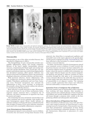 334  Nuclear Medicine: The Requisites
Osteomyelitis
Osteomyelitis is one of the oldest recorded diseases, first
described by Hippocrates in 400 bc.
The histopathology of acute osteomyelitis includes neu-
trophilic inflammation, edema, and vascular congestion.
Because of the bone’s rigidity, intramedullary pressure
increases, compromising the blood supply and causing isch-
emia and vascular thrombosis. Over several days, the sup-
purativeandischemicinjurymayresultinbonefragmentation
into devitalized segments called sequestra. Infection may
spread via haversian and Volkmann canals to the periosteum,
resulting in abscesses, soft-tissue infection, and sinus tracts.
With persistent infection, chronic inflammatory cells
(e.g., lymphocytes, histiocytes, plasma cells) join the neu-
trophils. Fibroblastic proliferation and new bone forma-
tion occur. Periosteal osteogenesis may surround the
inflammation to form a bony envelope, or involucrum.
Occasionally a dense fibrous capsule confines the infection
to a localized area (Brodie abscess).
Bone infection is usually bacterial in origin. Microorgan-
isms reach the bone by one of three mechanisms: hema-
togenous spread, extension from a contiguous site of
infection, and direct introduction of organisms into bone
by trauma and surgery.
The terminology for acute and chronic osteomyelitis is not
always consistent and can be confusing. Acute usually indi-
cates hematogenous spread. Chronic usually indicates an
infection starting in overlying soft tissue or introduced at the
time of surgery or trauma. It is an active infection, sometimes
reactivated, with a neutrophilic inflammatory component.
Acute Hematogenous Osteomyelitis
Hematogenous spread is most commonly seen in children.
It involves the red marrow of long bones because of the
relatively slow blood flow in metaphyseal capillaries and
sinusoidal veins in the region adjacent to the growth plate
and the paucity of phagocytes (Figs. 14-14 and 14-15). The
bone infection is often secondary to a distant staphylococ-
cal skin or mucosal infection.
In adults, osteomyelitis caused by hematogenous spread
most commonly occurs in diabetes. It rarely involves the
long bones because red marrow has been replaced by yel-
low marrow (adipose tissue). It typically occurs in vertebral
bodies, where the marrow is cellular with an abundant vas-
cular supply. Infection begins near the anterior longitudi-
nal ligament and spreads to adjacent vertebrae by direct
extension through the disk space or by communicating
venous channels. Because the adult disk does not have a
vascular supply, disk space infection is invariably the result
of osteomyelitis in an adjacent vertebra. The initiating
event is usually septicemia from urinary tract infection,
bacterial endocarditis, or intravenous drug abuse.
Extension From a Contiguous Site of Infection
The most common cause of osteomyelitis is direct extension
from overlying soft tissue infection, often secondary to
trauma, pressure sores, radiation therapy, or burns. In patients
with diabetes and vascular insufficiency, organisms enter the
soft tissues through a cutaneous ulcer, usually in the foot,
producing cellulitis and subsequently osteomyelitis.
Direct Introduction of Organisms Into Bone
Direct inoculation of infection may occur with open frac-
tures, open surgical reduction of closed fractures, or pen-
etrating trauma by foreign bodies. Osteomyelitis may also
arise from perioperative contamination of bone during
surgery for nontraumatic orthopedic disorders—for exam-
ple, laminectomy, diskectomy, or placement of a joint
prosthesis.
A B
Figure 14-13.  Lumbar spine osteomyelitis and infected orthopedic hardware. A, A 60-year-old man had spinal hardware implanted more than
8 years previously after a motor vehicle accident. He recently developed a draining left flank wound and was referred for evaluation of possible
infected orthopedic hardware. B, On the coronal images from the FDG PET/CT study linear left paraspinal hypermetabolism (arrowhead) along the
metal rod extends from approximately T-11 to L-3 with a standard uptake value (SUV) maximum of 9.3. This activity tracks to an open hypermeta-
bolic wound in the left flank (double arrow), with an SUV maximum of 7.3. Focal hypermetabolism (SUV maximum 8.7) can be seen in an upper
lumbar vertebra (arrow) consistent with osteomyelitis. (Courtesy Christopher Palestro, MD.)
 