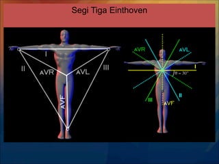 Segi Tiga Einthoven
 