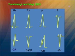 Terminologi morfologi QRS
qRs Rs R rS
QR Q/QS rSR’ rSr’
 