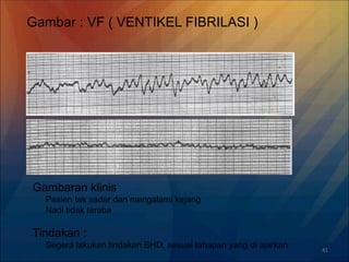41
Gambar : VF ( VENTIKEL FIBRILASI )
Gambaran klinis
Pasien tak sadar dan mengalami kejang
Nadi tidak teraba
Tindakan :
Segera lakukan tindakan BHD, sesuai tahapan yang di ajarkan
 