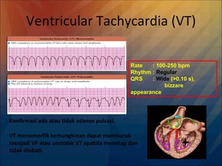 Ventricular Tachycardia (VT)
Konfirmasi ada atau tidak adanya pulsasi.
VT monomorfik kemungkinan dapat memburuk
menjadi VF atau unstable VT apabila menetap dan
tidak diobati.
Rate : 100-250 bpm
Rhythm : Regular
QRS : Wide (>0.10 s),
bizzare
appearance
 