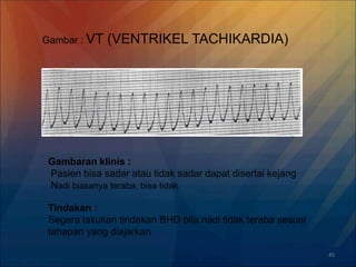 45
Gambar : VT (VENTRIKEL TACHIKARDIA)
Gambaran klinis :
Pasien bisa sadar atau tidak sadar dapat disertai kejang
Nadi biasanya teraba, bisa tidak
Tindakan :
Segera lakukan tindakan BHD bila nadi tidak teraba sesuai
tahapan yang diajarkan
 
