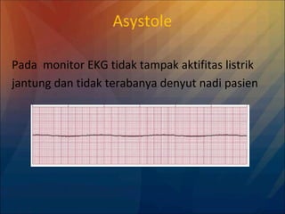 Asystole
Pada monitor EKG tidak tampak aktifitas listrik
jantung dan tidak terabanya denyut nadi pasien
 