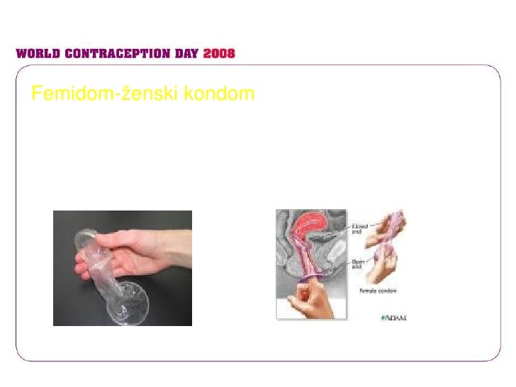 kako staviti kondom