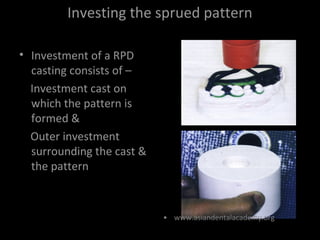 lab procedures in removable partial dentures | PPT