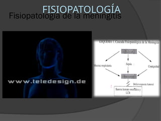 Fisiopatología de la meningitis
FISIOPATOLOGÍA
 