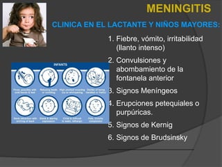 1. Fiebre, vómito, irritabilidad
(llanto intenso)
2. Convulsiones y
abombamiento de la
fontanela anterior
3. Signos Meníngeos
4. Erupciones petequiales o
purpúricas.
5. Signos de Kernig
6. Signos de Brudsinsky
____________________________
CLINICA EN EL LACTANTE Y NIÑOS MAYORES:
MENINGITIS
 