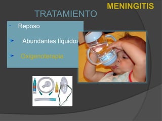 TRATAMIENTO
Reposo
Abundantes líquidos
Oxigenoterapia
MENINGITIS
 