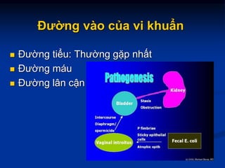 Đường vào của vi khuẩn
 Đường tiểu: Thường gặp nhất
 Đường máu
 Đường lân cận
 