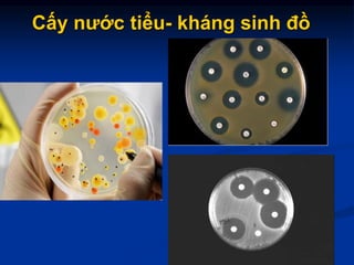 Cấy nước tiểu- kháng sinh đồ
 