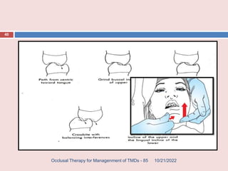 14 Occlusal therapy for management of TMDs.pptx