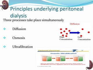 Principles underlying peritoneal
dialysis
Three processes take place simultaneously
 Diffusion
 Osmosis
 Ultrafiltration
 