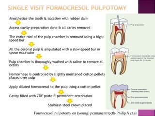 Anesthetize the tooth & isolation with rubber dam
Access cavity preparation done & all caries removed
The entire roof of the pulp chamber is removed using a high-
speed bur
All the coronal pulp is amputated with a slow-speed bur or
spoon excavator
Pulp chamber is thoroughly washed with saline to remove all
debris
Hemorrhage is controlled by slightly moistened cotton pellets
placed over pulp
Apply diluted formocresol to the pulp using a cotton pellet
Cavity filled with ZOE paste & permanent restoration
Stainless steel crown placed
Formocresol pulpotomy on (young) permanent teeth-Philip A et.al
 