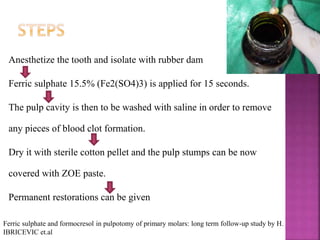 Anesthetize the tooth and isolate with rubber dam
Ferric sulphate 15.5% (Fe2(SO4)3) is applied for 15 seconds.
The pulp cavity is then to be washed with saline in order to remove
any pieces of blood clot formation.
Dry it with sterile cotton pellet and the pulp stumps can be now
covered with ZOE paste.
Permanent restorations can be given
Ferric sulphate and formocresol in pulpotomy of primary molars: long term follow-up study by H.
IBRICEVIC et.al
 
