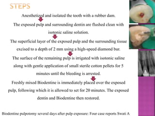 Anesthetized and isolated the tooth with a rubber dam.
The exposed pulp and surrounding dentin are flushed clean with
isotonic saline solution.
The superficial layer of the exposed pulp and the surrounding tissue
excised to a depth of 2 mm using a high-speed diamond bur.
The surface of the remaining pulp is irrigated with isotonic saline
along with gentle application of small sterile cotton pellets for 5
minutes until the bleeding is arrested.
Freshly mixed Biodentine is immediately placed over the exposed
pulp, following which it is allowed to set for 20 minutes. The exposed
dentin and Biodentine then restored.
Biodentine pulpotomy several days after pulp exposure: Four case reports Swati A
 