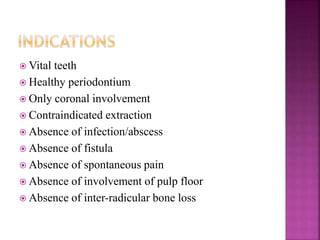  Vital teeth
 Healthy periodontium
 Only coronal involvement
 Contraindicated extraction
 Absence of infection/abscess
 Absence of fistula
 Absence of spontaneous pain
 Absence of involvement of pulp floor
 Absence of inter-radicular bone loss
 