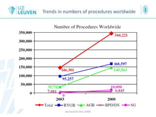 Trends in numbers of procedures worldwide
Buchwald & Oien (2009)
 