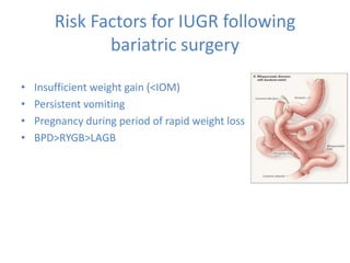 Risk Factors for IUGR following
bariatric surgery
• Insufficient weight gain (<IOM)
• Persistent vomiting
• Pregnancy during period of rapid weight loss
• BPD>RYGB>LAGB
 