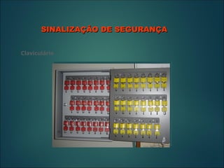 SINALIZAÇÃO DE SEGURANÇA
SINALIZAÇÃO DE SEGURANÇA
Claviculário
 
