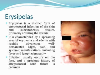 Erysipelas
 Erysipelas is a distinct form of
streptococcal infection of the skin
and subcutaneous tissues,
primarily affecting the dermis
 It is characterized by a spreading
area of erythema and edema with
rapidly advancing, well-
demarcated edges, pain, and
systemic manifestations, including
fever and lymphadenopathy
 Infection usually occurs on the
face, and a previous history of
streptococcal sore throat is
common
 