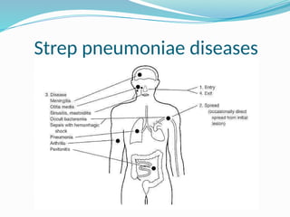 Strep pneumoniae diseases
 