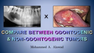Mohammed	A.	Alawad
COMPARE BETWEEN ODONTOGENIC
& NON-ODONTOGENIC TUMORS
X
 