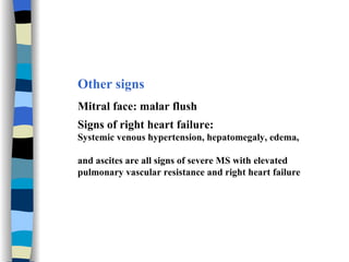 Other signs Mitral face: malar flush Signs of right heart failure: Systemic venous hypertension, hepatomegaly, edema,  and ascites are all signs of severe MS with elevated  pulmonary vascular resistance and right heart failure 