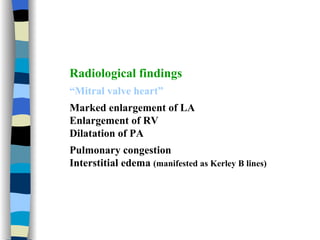 Radiological findings   “ Mitral valve heart ” Marked enlargement of LA Enlargement of RV Dilatation of PA Pulmonary congestion Interstitial edema  (manifested as Kerley B lines)   