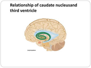 Relationship of caudate nucleusand
third ventricle
 