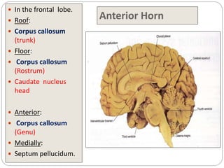 Anterior Horn
 In the frontal lobe.
 Roof:
 Corpus callosum
(trunk)
 Floor:
 Corpus callosum
(Rostrum)
 Caudate nucleus
head
 Anterior:
 Corpus callosum
(Genu)
 Medially:
 Septum pellucidum.
 