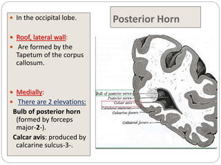Posterior Horn
 In the occipital lobe.
 Roof, lateral wall:
 Are formed by the
Tapetum of the corpus
callosum.
 Medially:
 There are 2 elevations:
Bulb of posterior horn
(formed by forceps
major-2-).
Calcar avis: produced by
calcarine sulcus-3-.
 